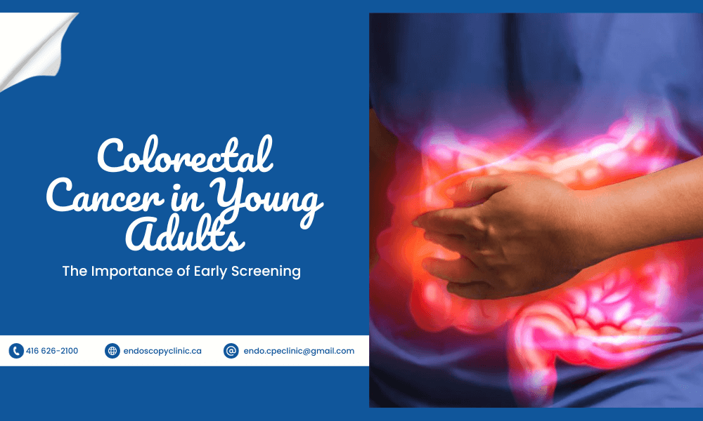 colorectal cancer in young adults