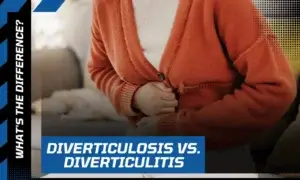 diverticulosis vs diverticulitis